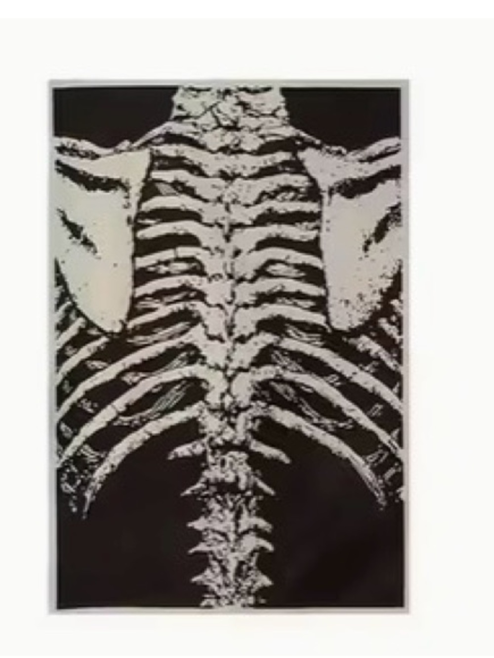 Large skeleton patch - new